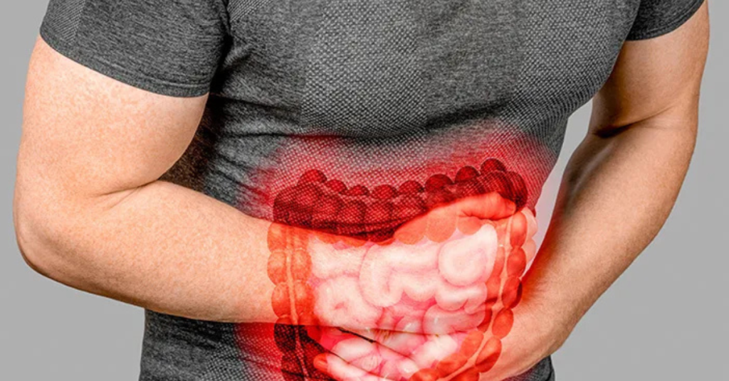 Pilihan Selamat Cara Buang Toksin Dalam Badan